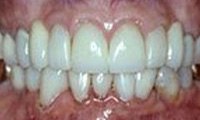 Healthy beautiful teeth and gums after dental treatment