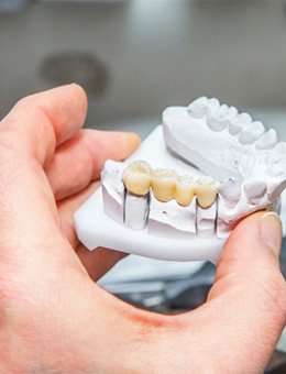 Dental bridge in Murphy on clay model