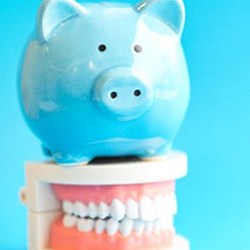 Piggy bank atop model teeth representing the cost of dental emergencies