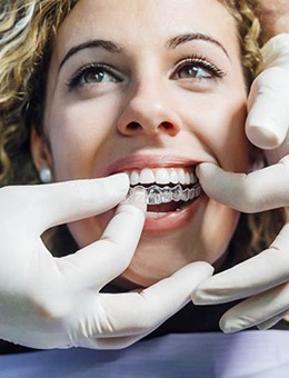 Woman with curly hair being fitted for Invisalign