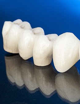 Animated image of dental crown restorations