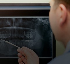 All digital dental x-rays on chairside computer
