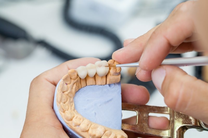 A dental technician putting the finishing touches on a dental crown